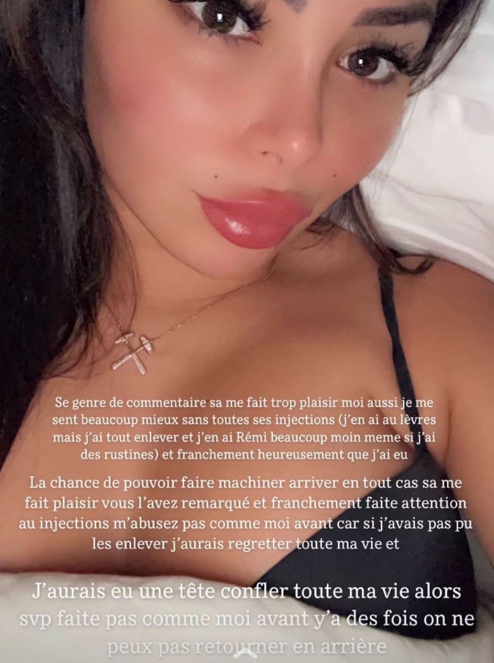 Maeva Ghennam : elle se vante de son 'glow up' après avoir retiré ses injections aux visages