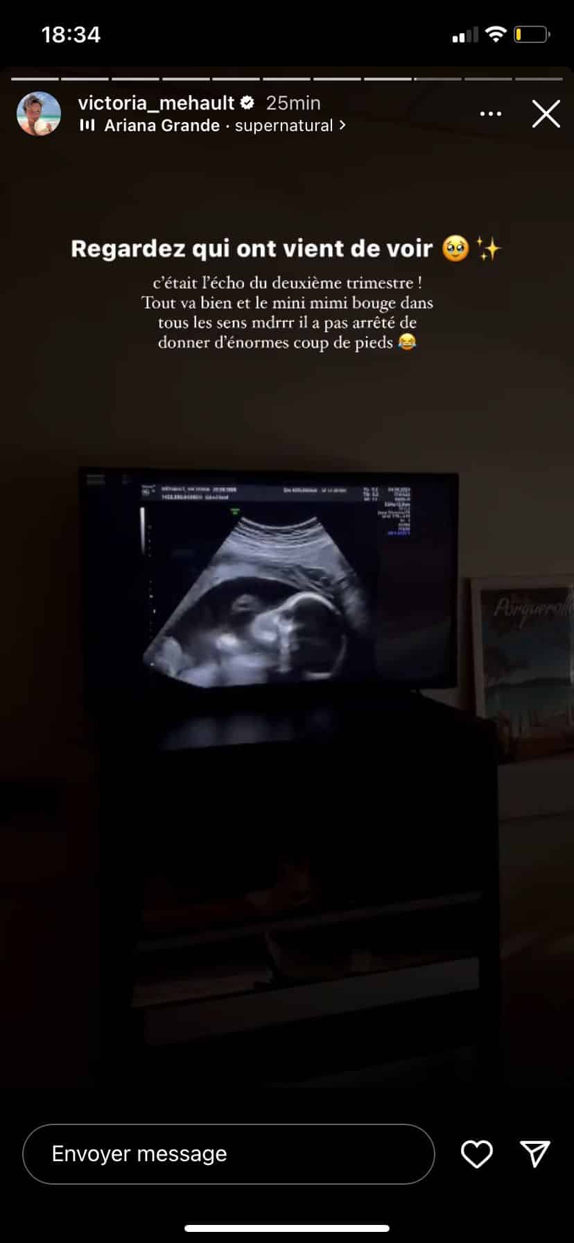 Victoria Mehault : enceinte, elle montre la 1ère photo de son bébé