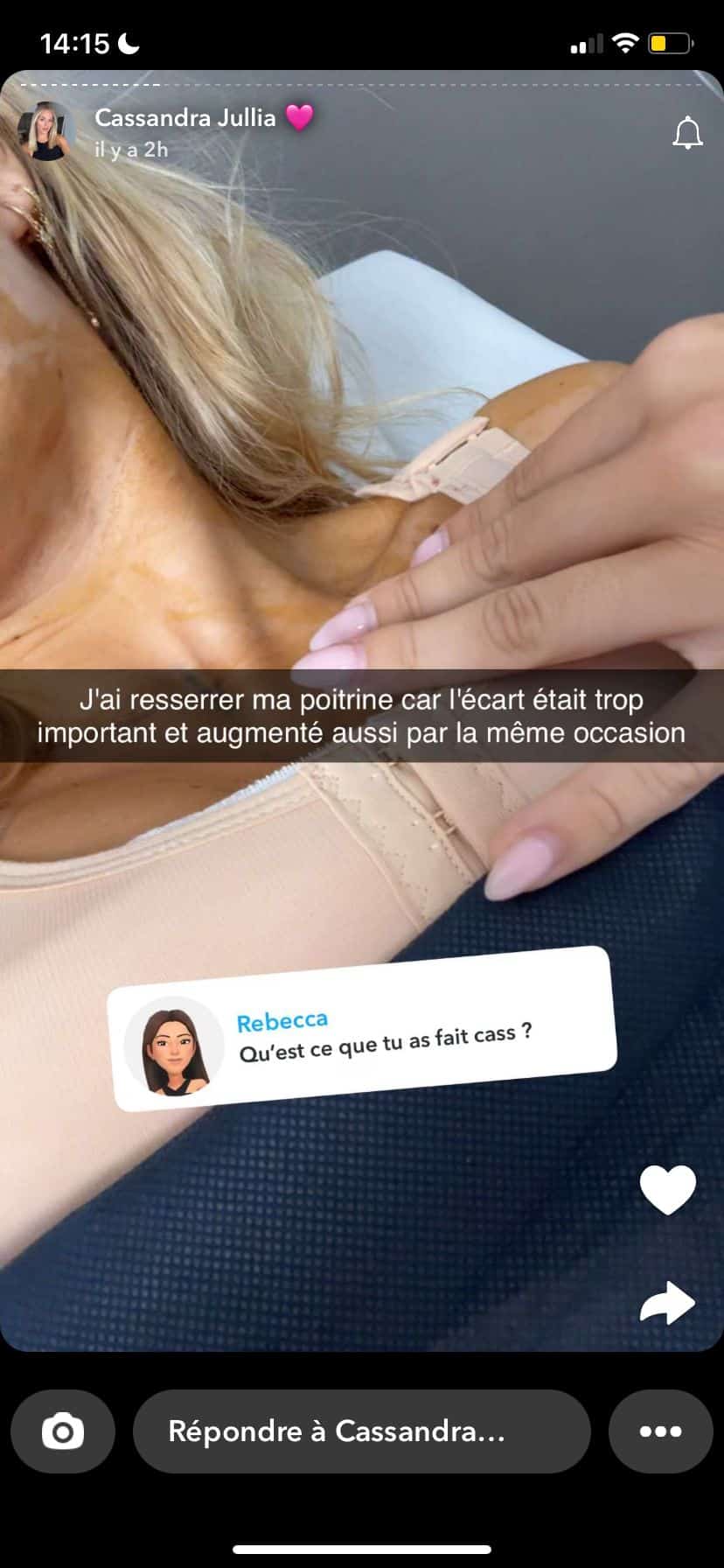 Cassandra Jullia : au plus mal après sa dernière opération de chirurgie esthétique, les internautes s'alarment