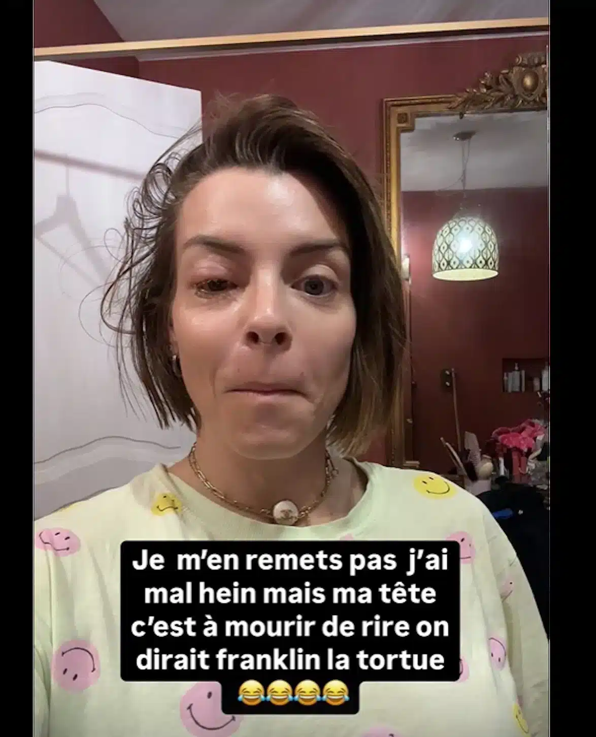 Alexia Mori (Secret Story) : défigurée, elle montre des photos troublantes de son visage