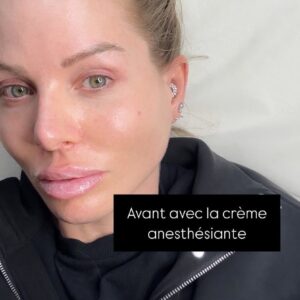 Jessica Thivenin : accusée d'abuser de la chirurgie esthétique, elle montre ses nouvelles lèvres