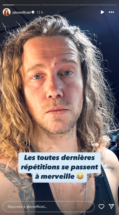 Julien Doré : le chanteur se blesse au front juste avant un concert